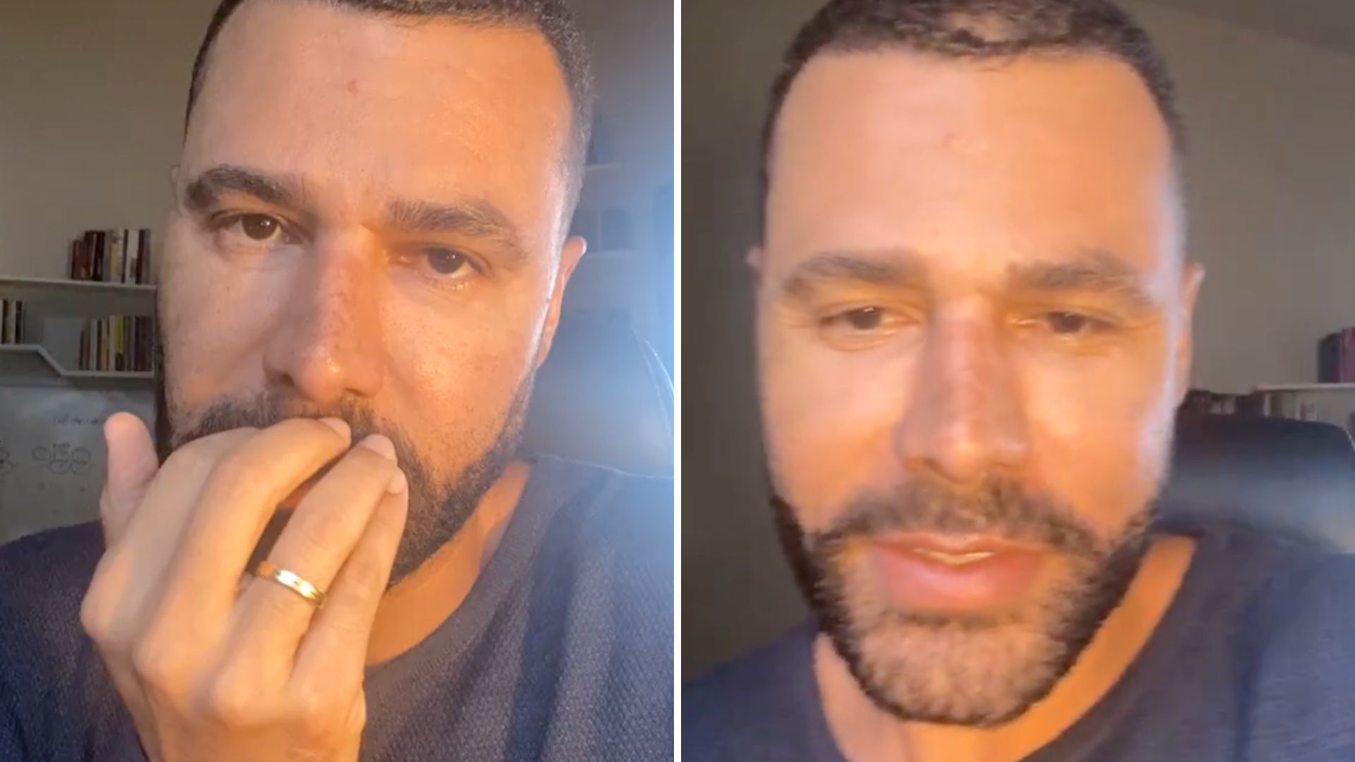 Rodrigo Sant’anna volta atrás após procedimentos estéticos: ‘Harmonizado consciente’