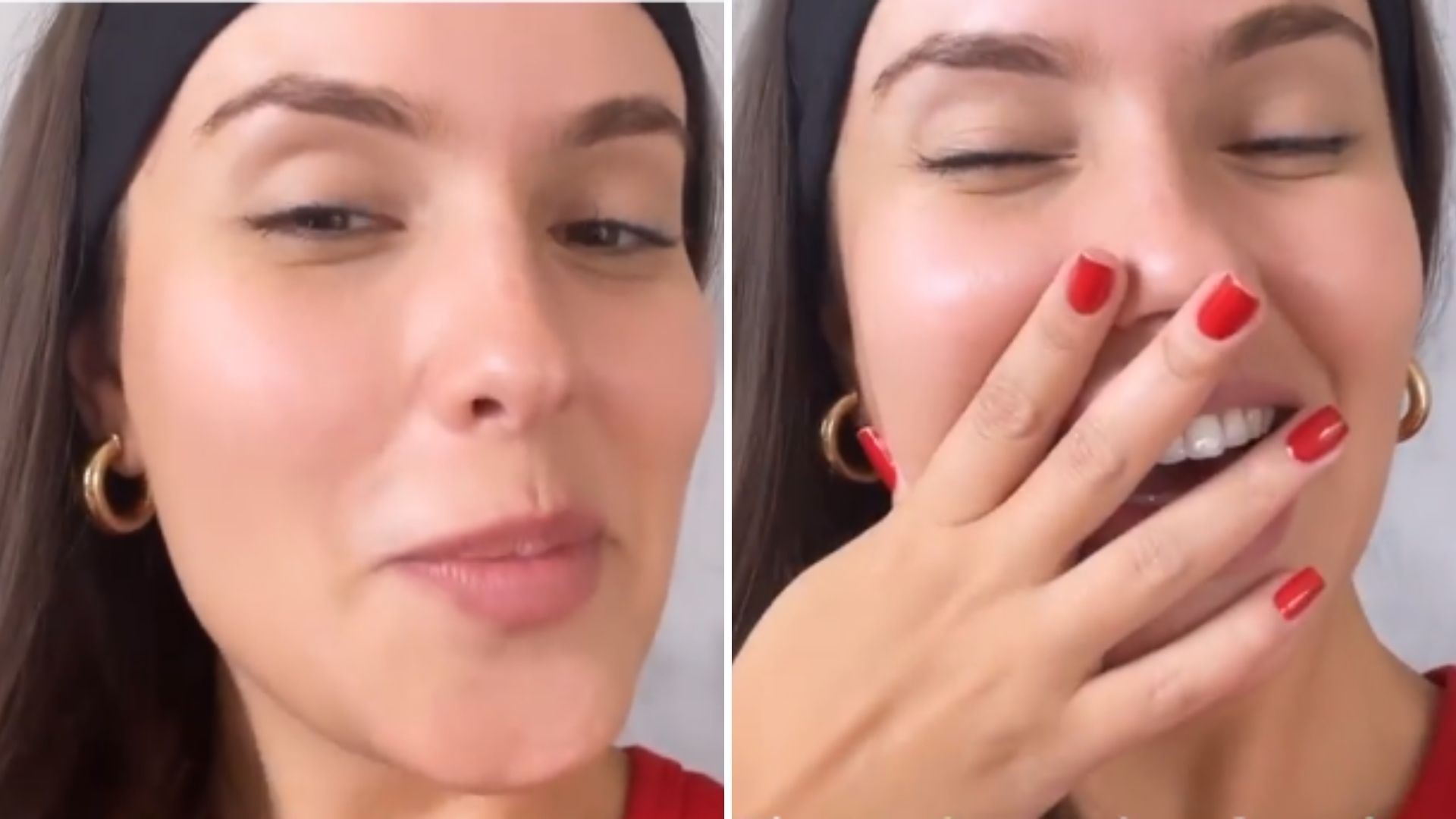 Após diminuir testa, ex-BBB Thaís Braz já pensa em nova cirurgia: “É um caos”