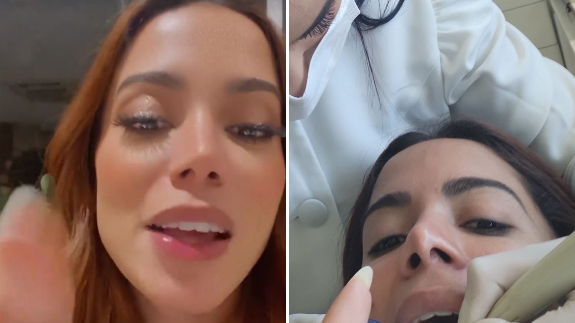 Anitta tira foto no dentista e exalta saúde no Brasil: “Não tem igual”