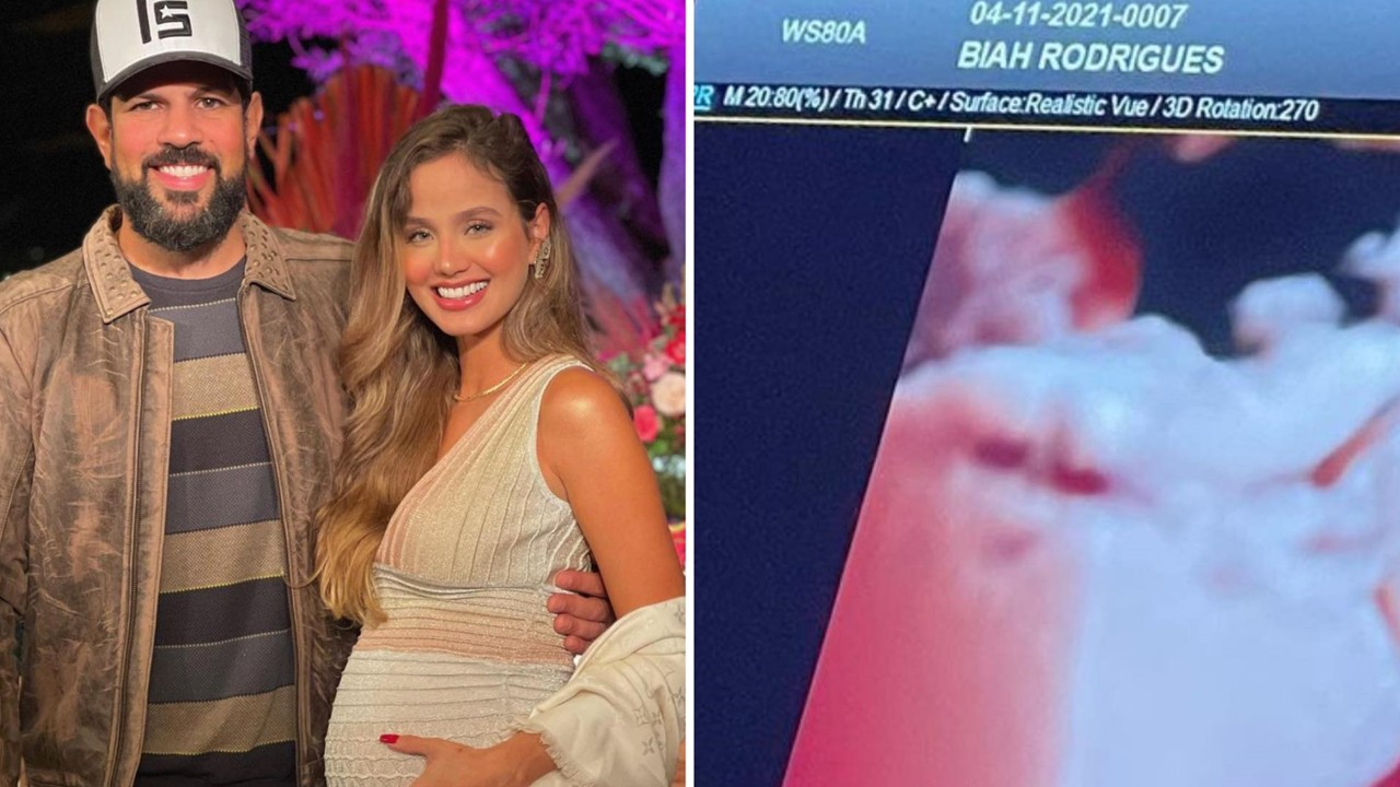 Gravidíssima, esposa de Sorocaba mostra ultrassom da filha e detalhe intriga: “Coisa linda”