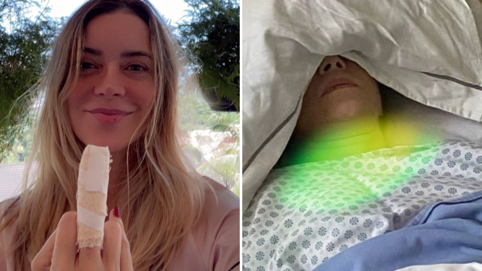 Christine Fernandes sofre fratura no dedo do meio: “Enverga, mas não quebra”