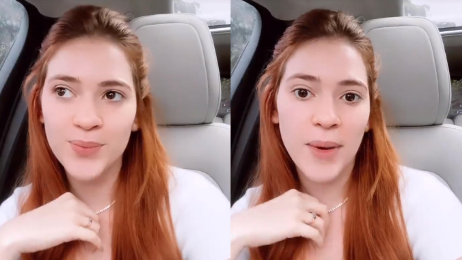 Ex-BBB Ana Clara Lima tranquiliza fãs após sofrer acidente: “Tomando remédios”