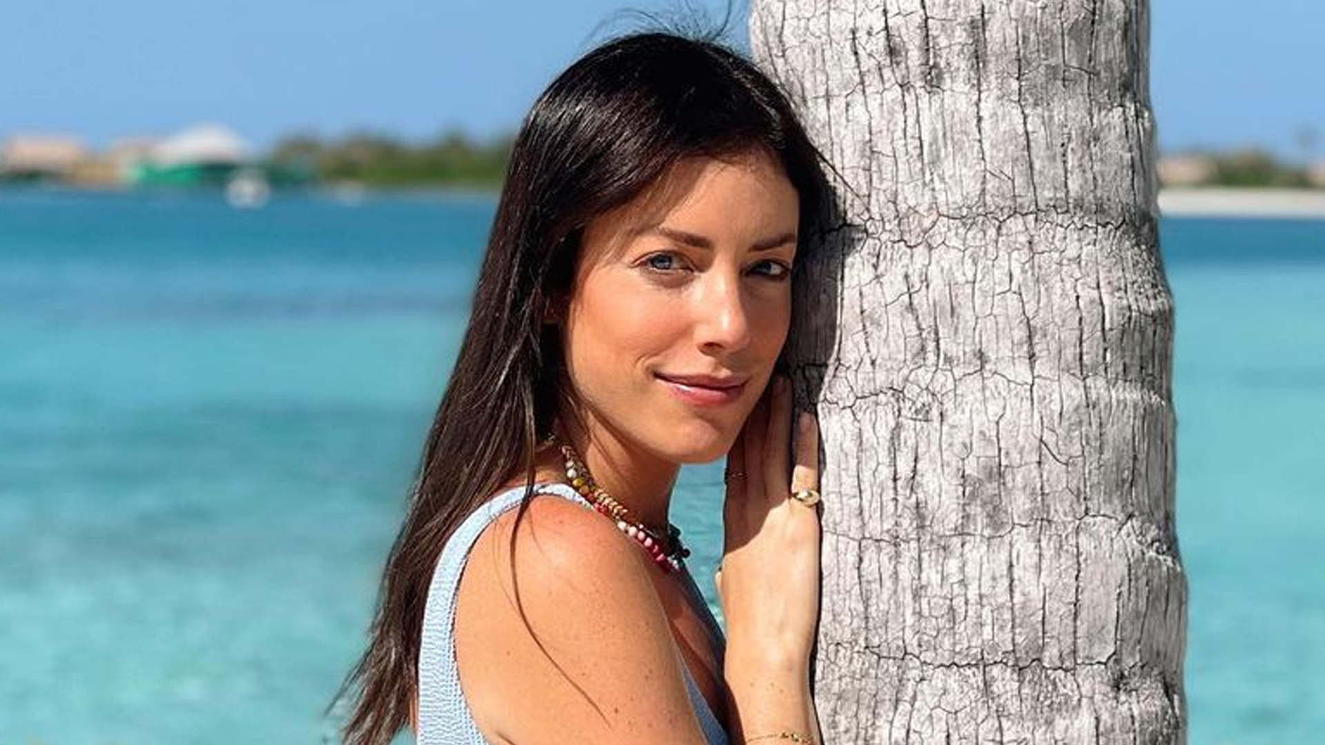 Fabiana Justus mostra antes e depois com 11 kg a menos: “Dá pra ver bem”
