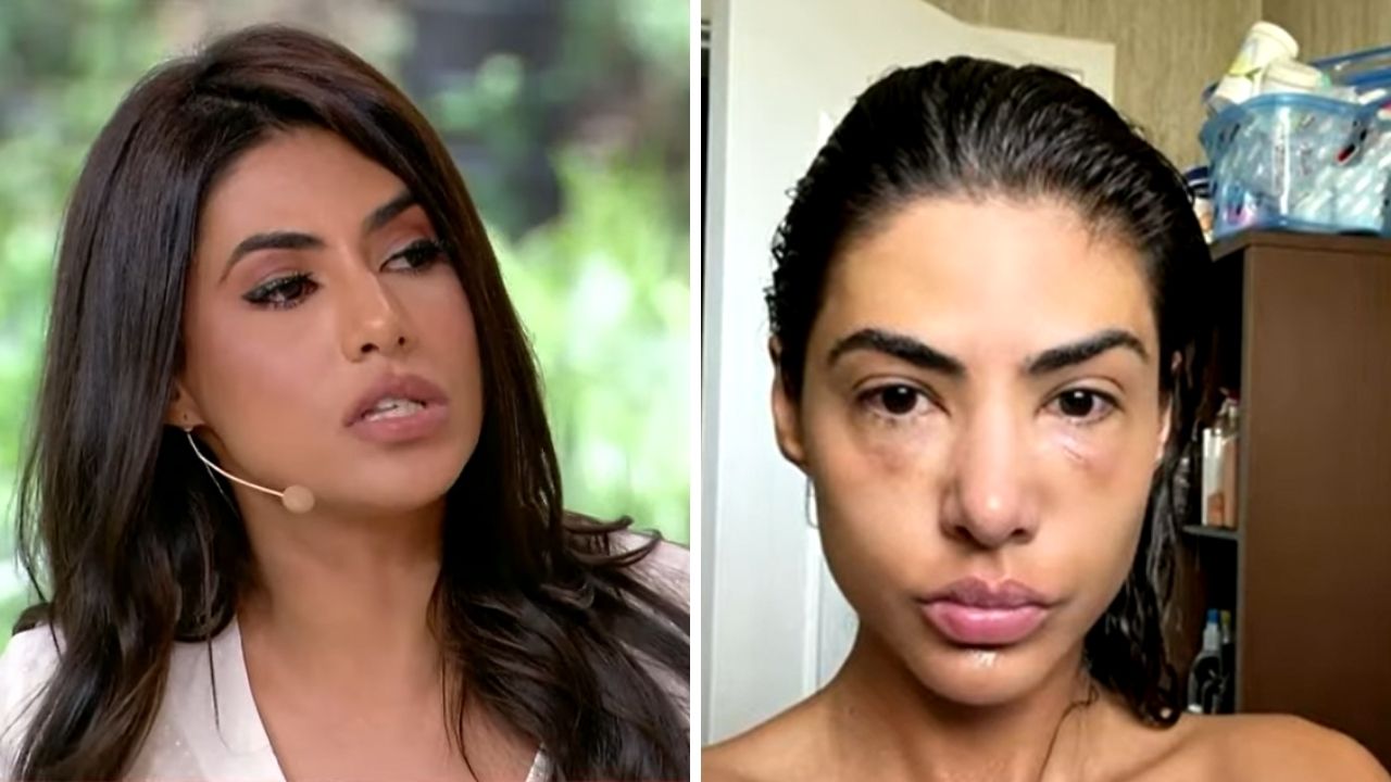 Flávia Noronha relata desespero ao ser diagnosticada com doença grave: “Fiquei assustada”