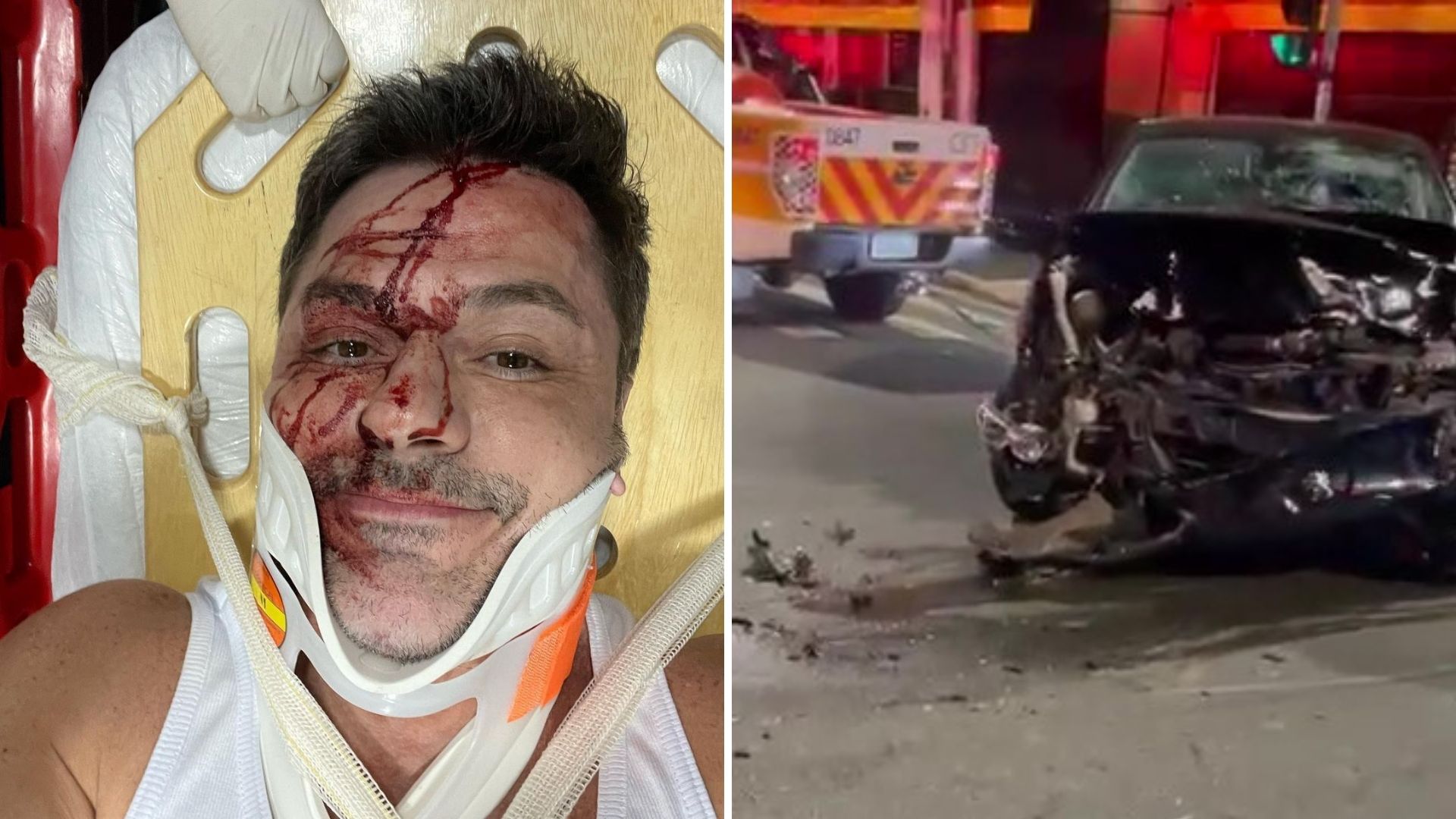 Irmão do Rodrigo Faro sofre acidente de carro e fratura costela: “Nasci de novo”