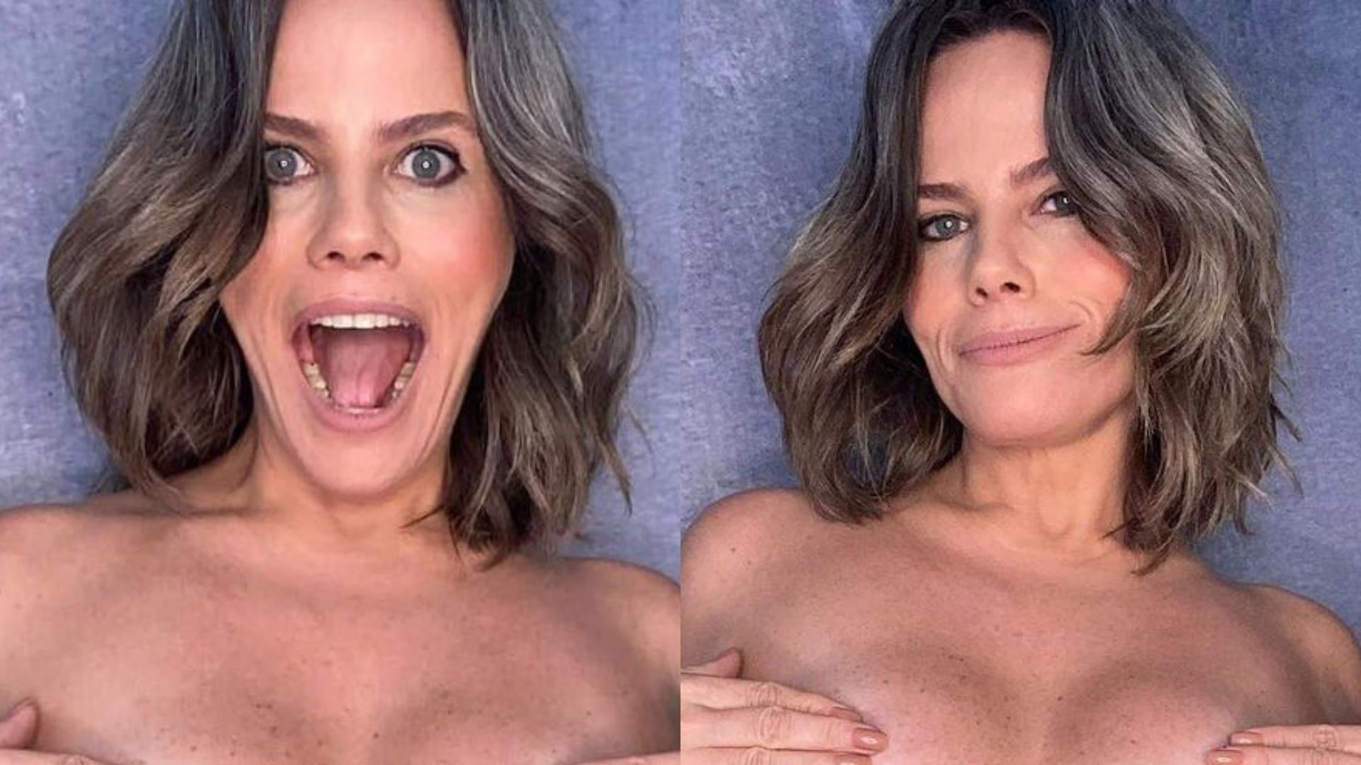 Realista, Maria Cândida revela cicatrizes nos seios e toma decisão radical: “Ressignificar”