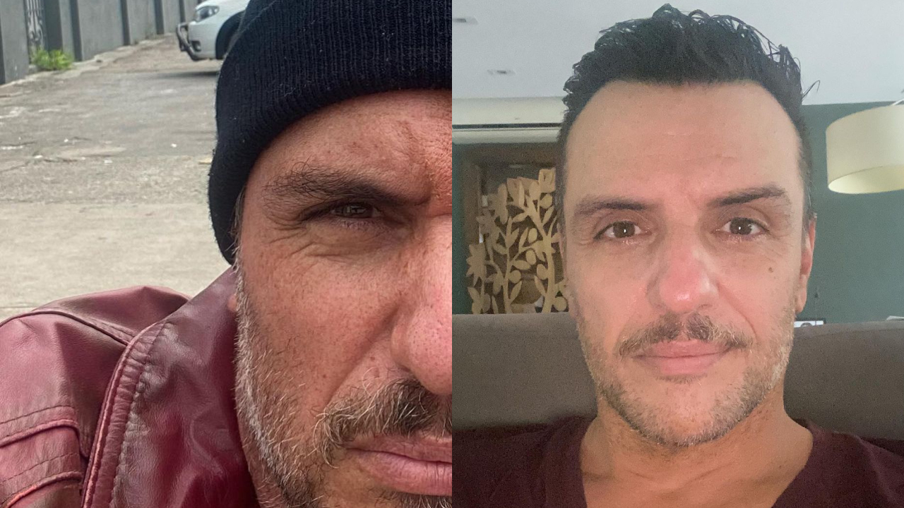 Rodrigo Lombardi posa com cicatriz no rosto e aumenta suspeitas de retorno a ‘Verdades Secretas’