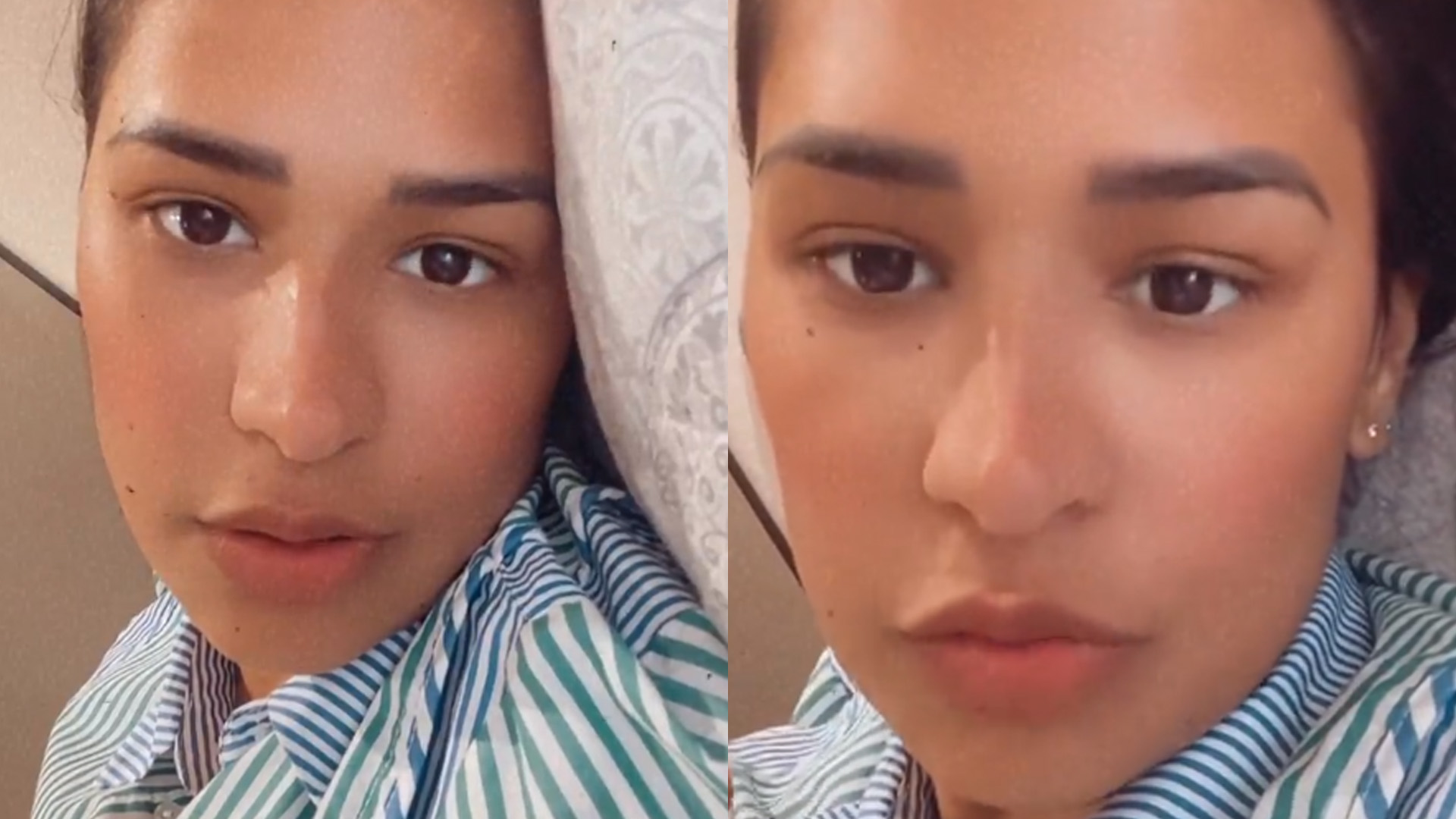 Simone passa por abdominoplastia após perder muito peso: “Muita pele”