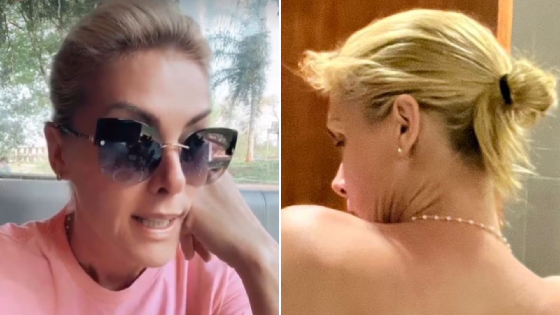 Ana Hickmann sofre acidente, expõe ferimentos e detalha situação: “Fiquei sem ar”