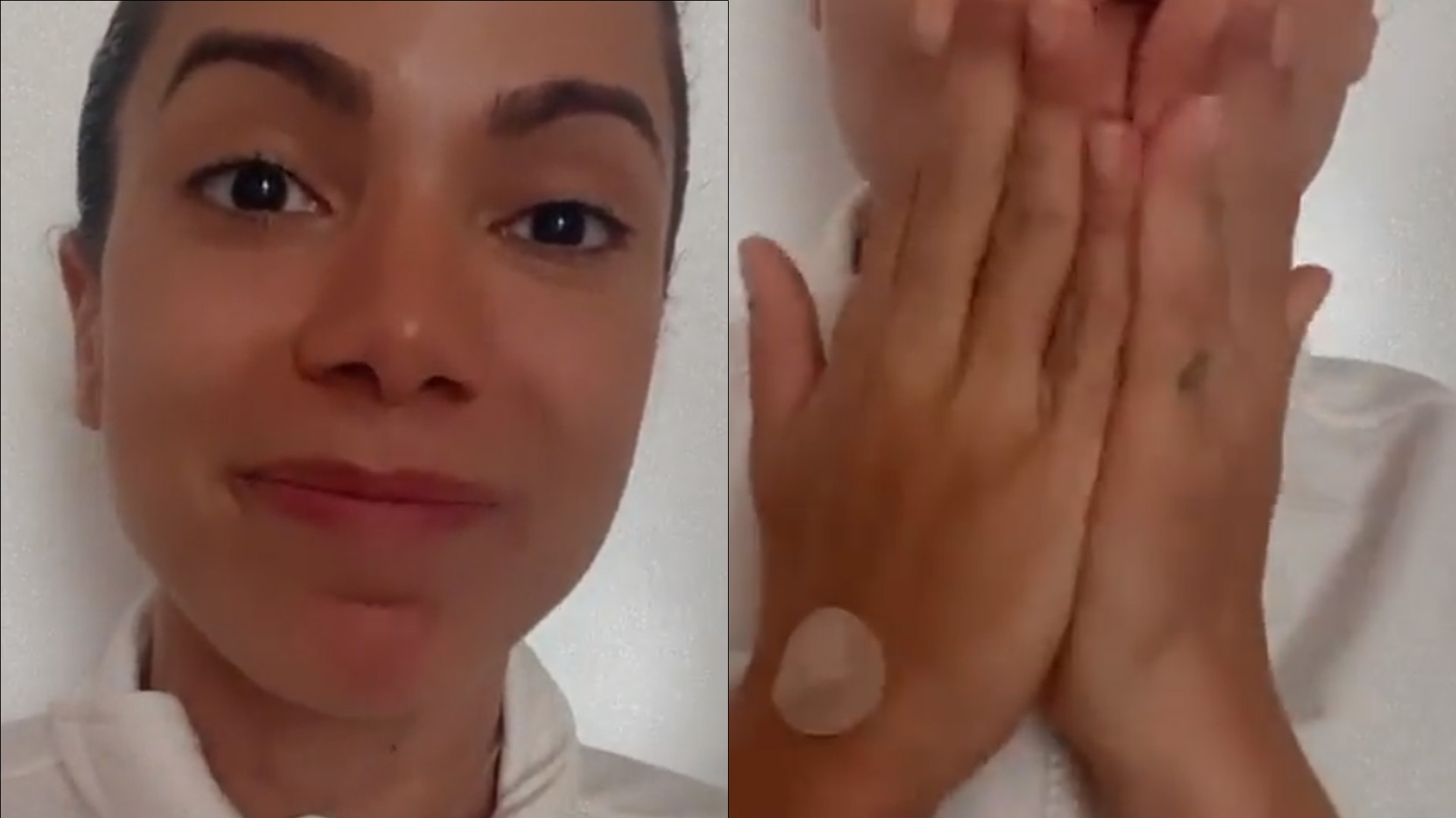 Abatida, Anitta surge com curativos e sonda escondida no pescoço: “Ela tá bem?”