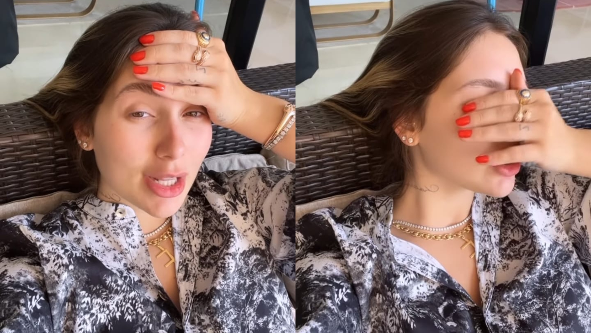Cefaleia tensional: saiba o que é o problema, muito comum, que afeta Virginia Fonseca