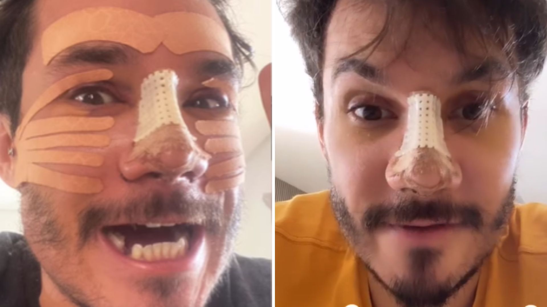Eliezer compra briga com fã ao ser criticado por harmonizações faciais: “Tô corrigindo”