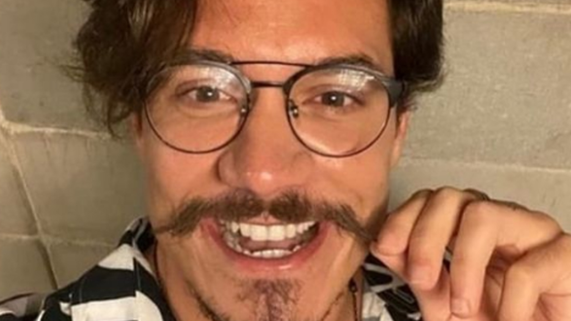 Ex-BBB Eliezer mostra antes e depois de procedimentos e impressiona: “Rejuvenesceu”