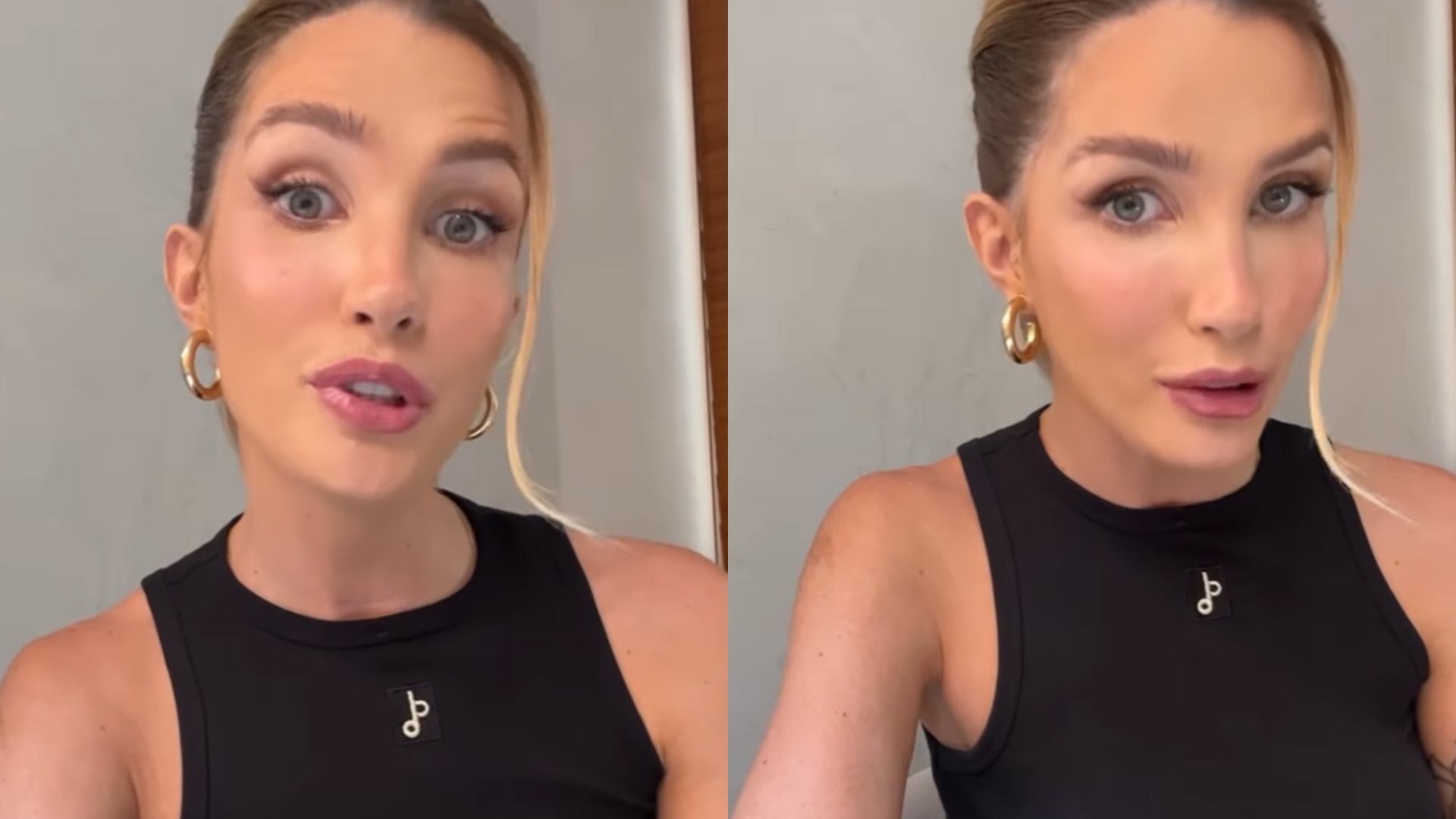 Ex-BBB Aline Gotschalg desabafa sobre câncer de tireoide e perda de voz: “Medo de morrer”