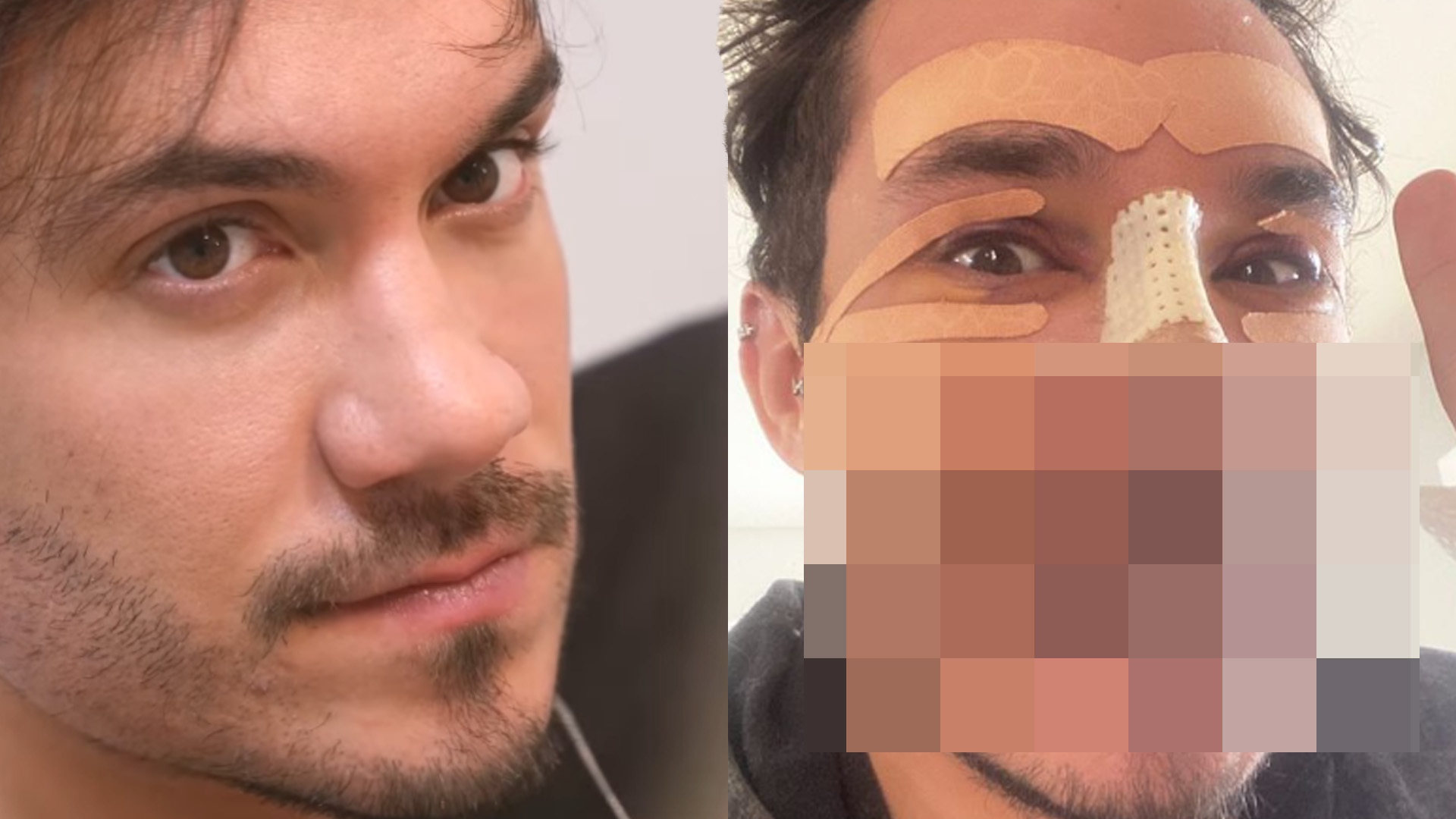 Ex-BBB Eliezer assusta fãs ao aparecer desdentado: “Pra ficar bonito tem que ficar feio”