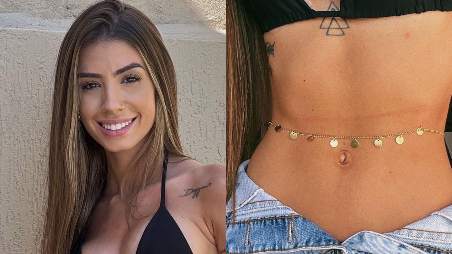 Ex de Whindersson Nunes dá zoom em seios volumosos após colocar silicone: “Gata”