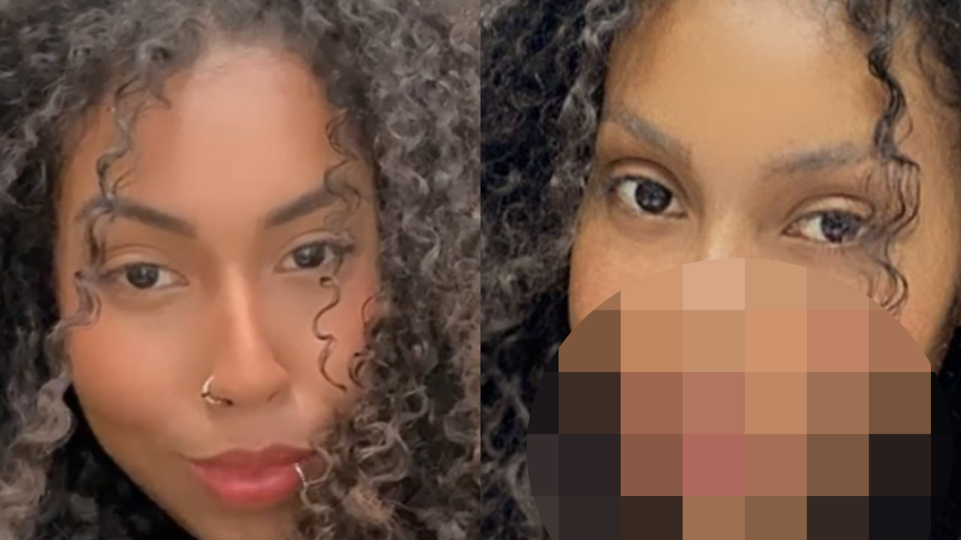 Irmã de Gracyanne Barbosa passa por cirurgia radical no rosto e mostra resultado: “Amando”