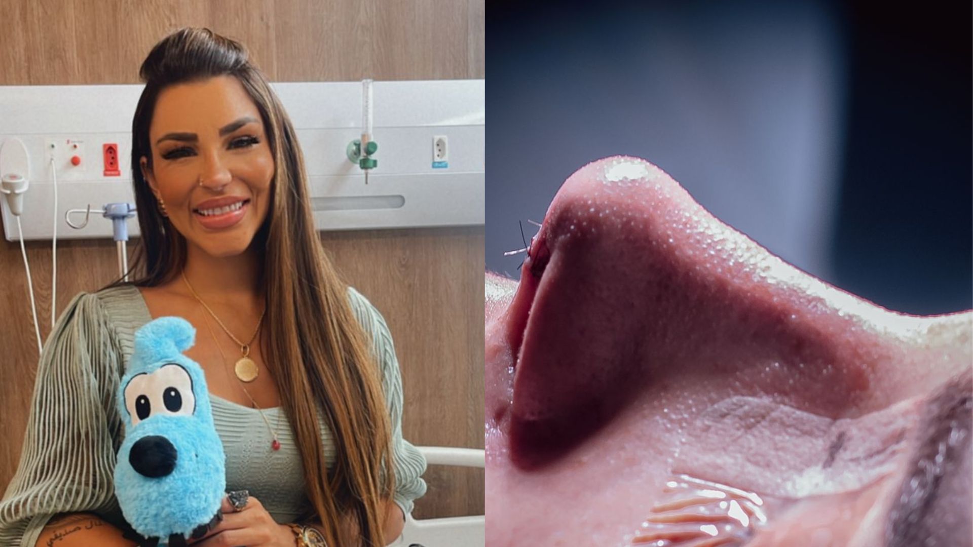 Jenny Miranda gasta R$200 mil e passa por vários procedimentos de uma tacada só