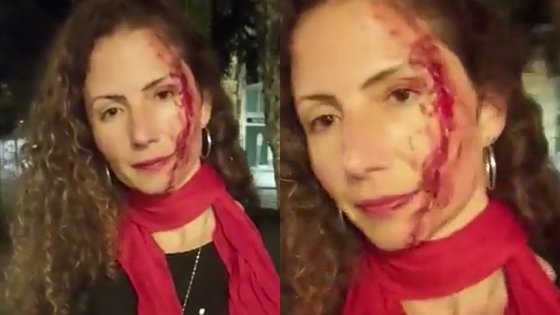 Jornalista da CNN é espancada na rua ao andar com adesivo do Lula: “Fui atacada”