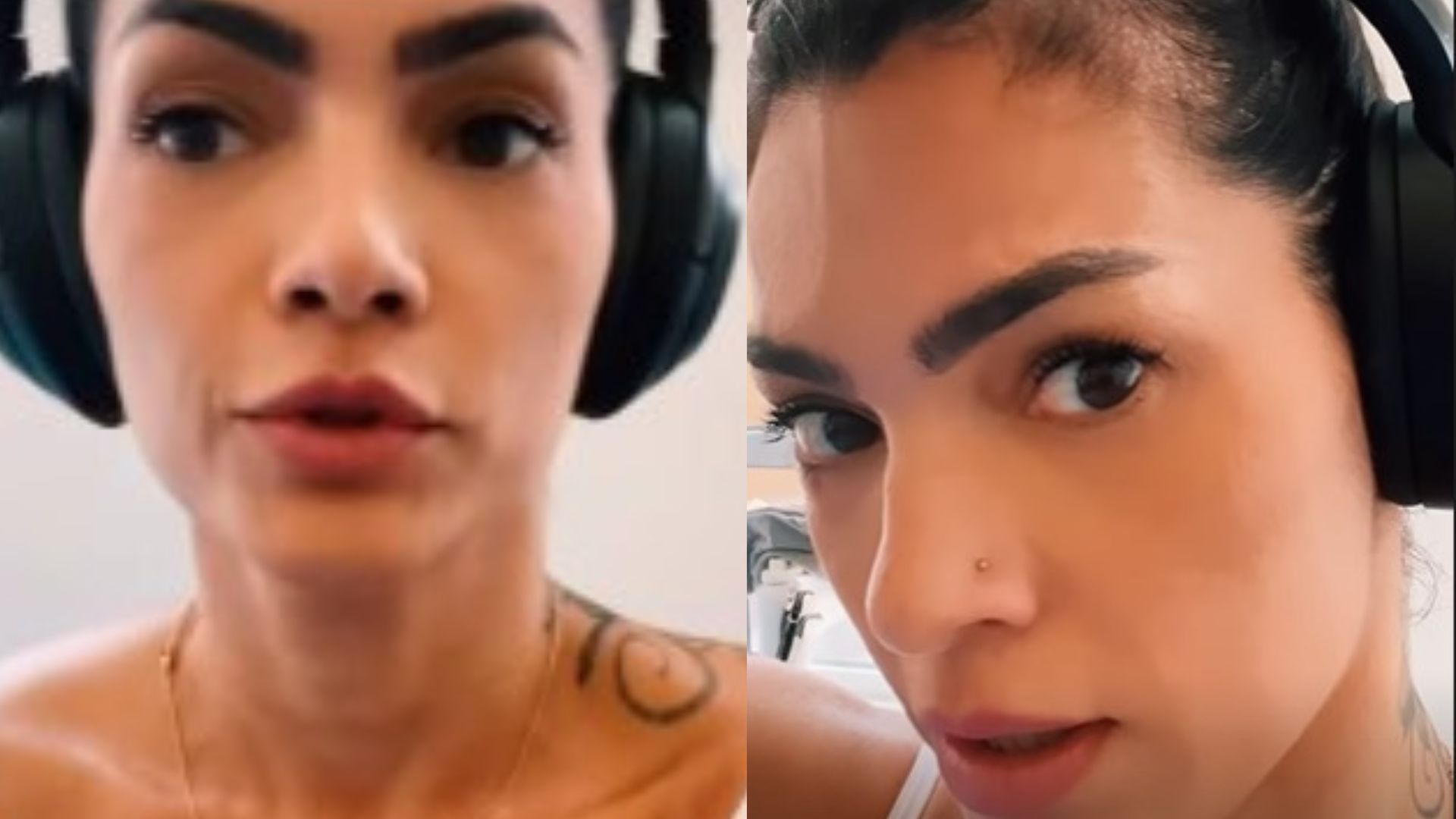 Kelly Key desabafa sobre tratamento para doença e preocupa fãs com manchas pelo corpo: “Oscilações”