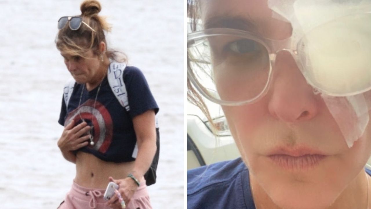 Cristiana Oliveira sofre acidente bizarro durante caminhada: “Um passeio inofensivo”