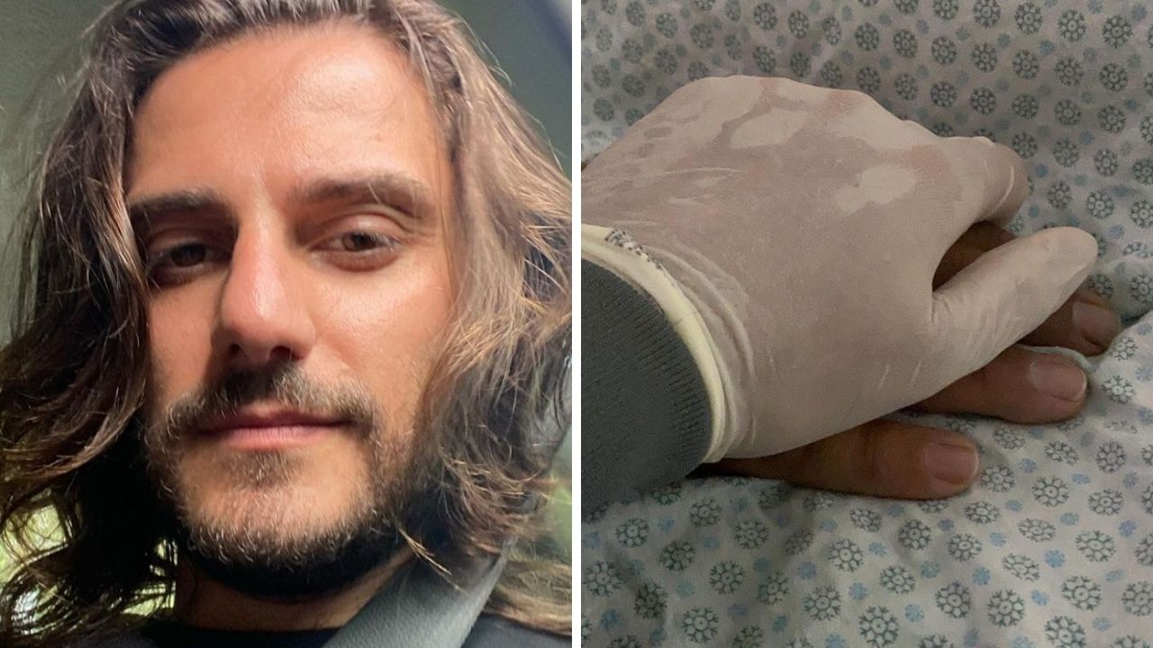 Hugo Bonemer anuncia a morte do pai após tentar de tudo: “Há limites pra toda batalha”