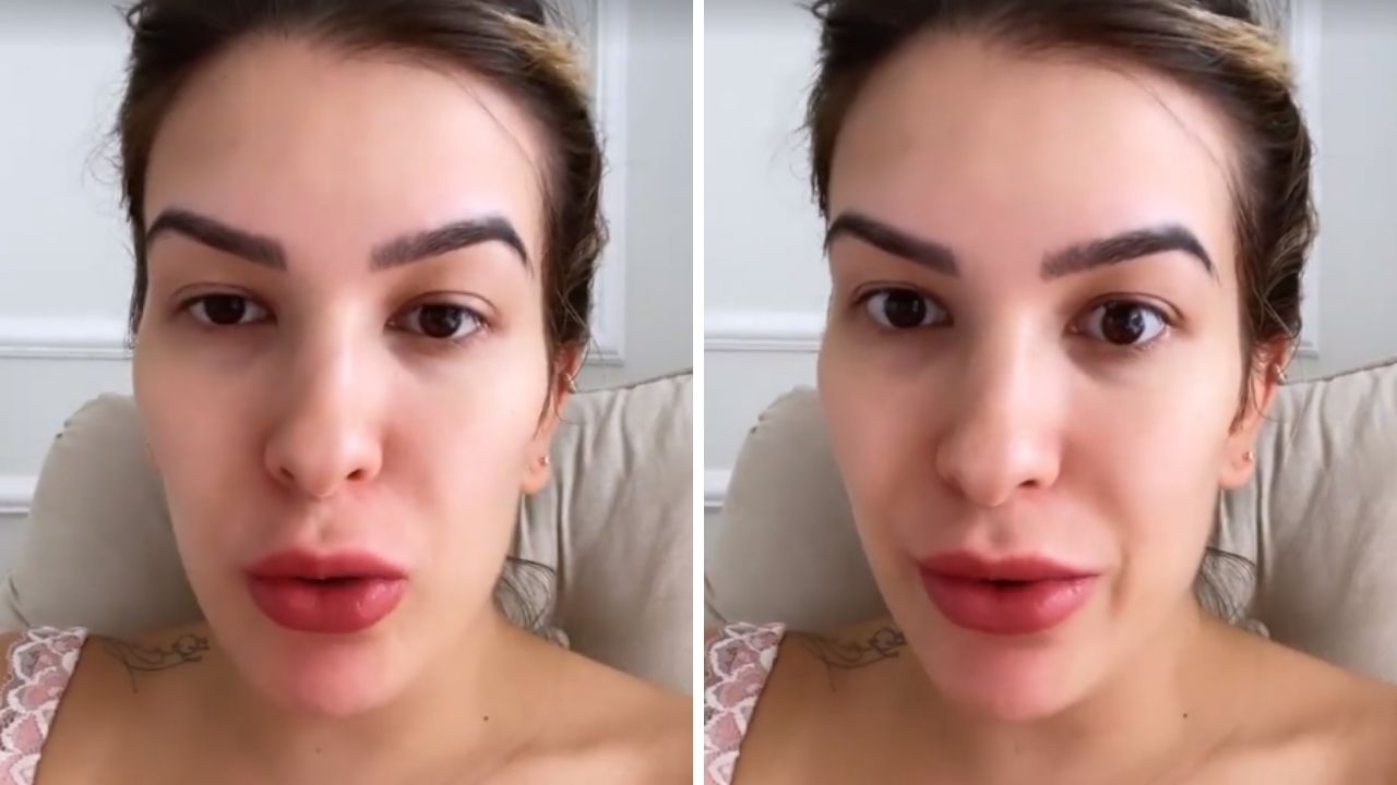 Lore Improta encontra hematoma roxo no braço da filha de um mês, Liz, e se preocupa: “Estou arrasada”