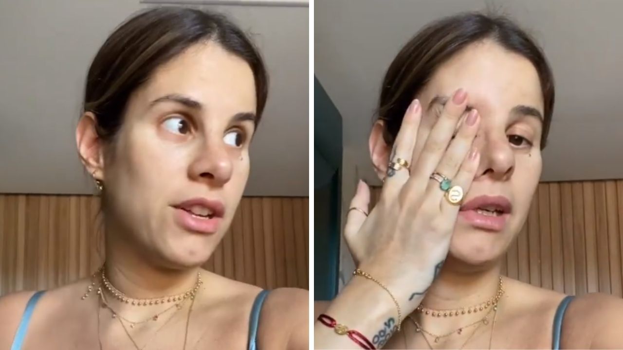 No pós-parto, Shantal dá show de realidade e mostra barriga manchada após tomar sol: “Pensa bem antes”