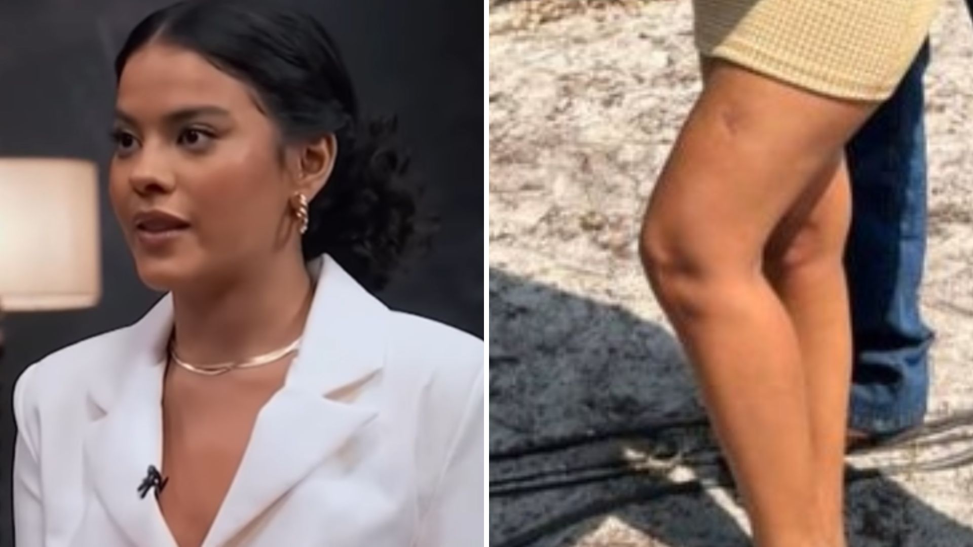 Muda de ‘Pantanal’, Bella Campos revela que foi atacada por jacaré: “Abocanhou minha perna”