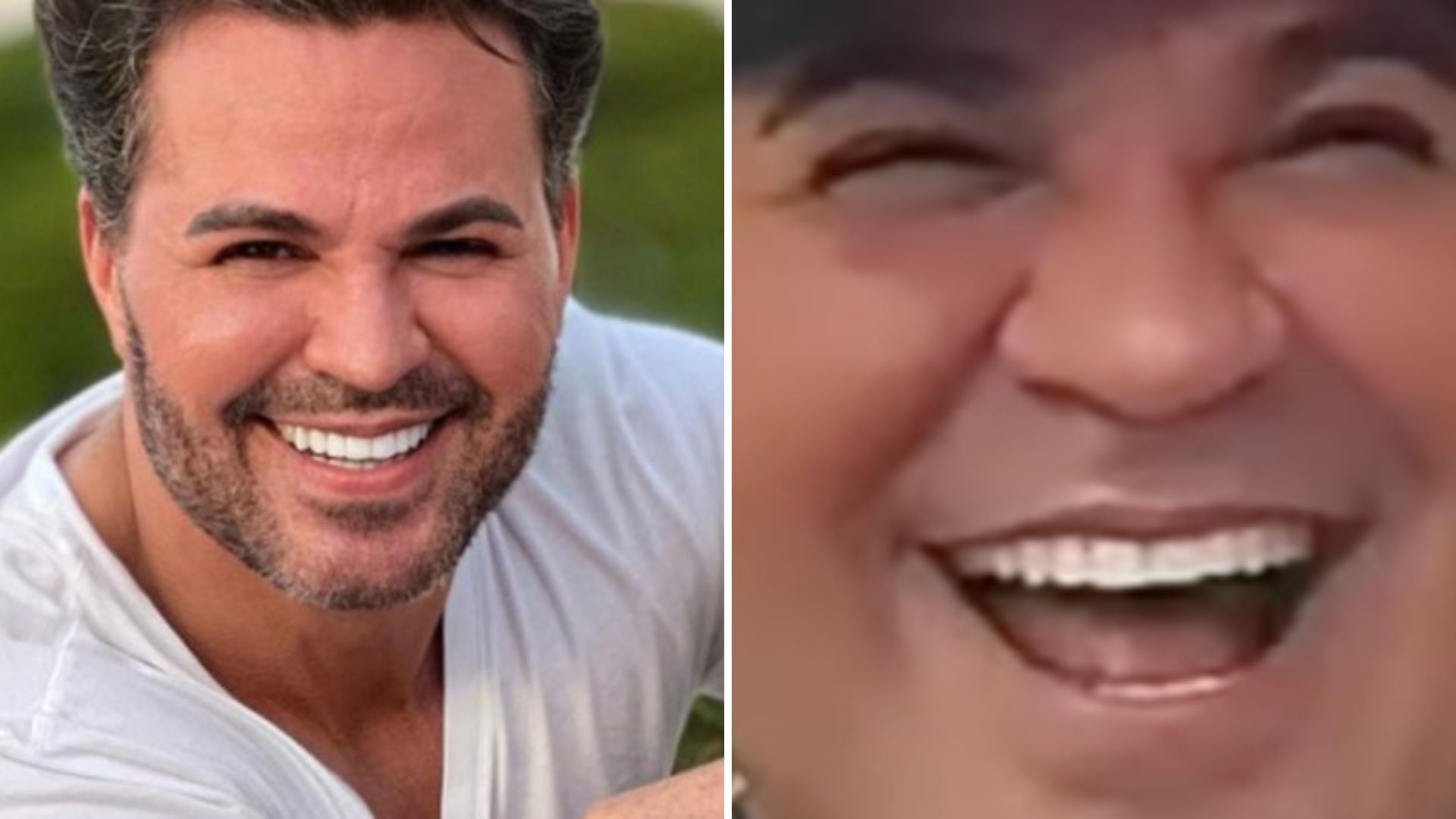 Eduardo Costa surge irreconhecível em vídeo e assusta fãs: “Não abre mais o olho”