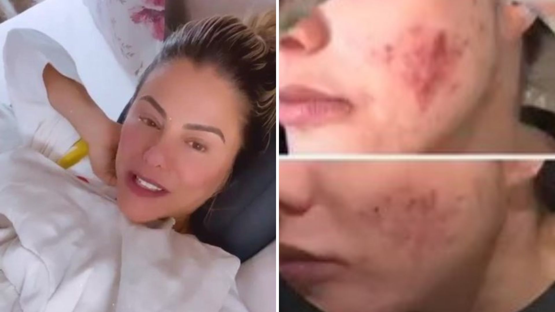Esposa de Leonardo surge com a pele irreconhecível e lamenta: “Extremamente ansiosa”