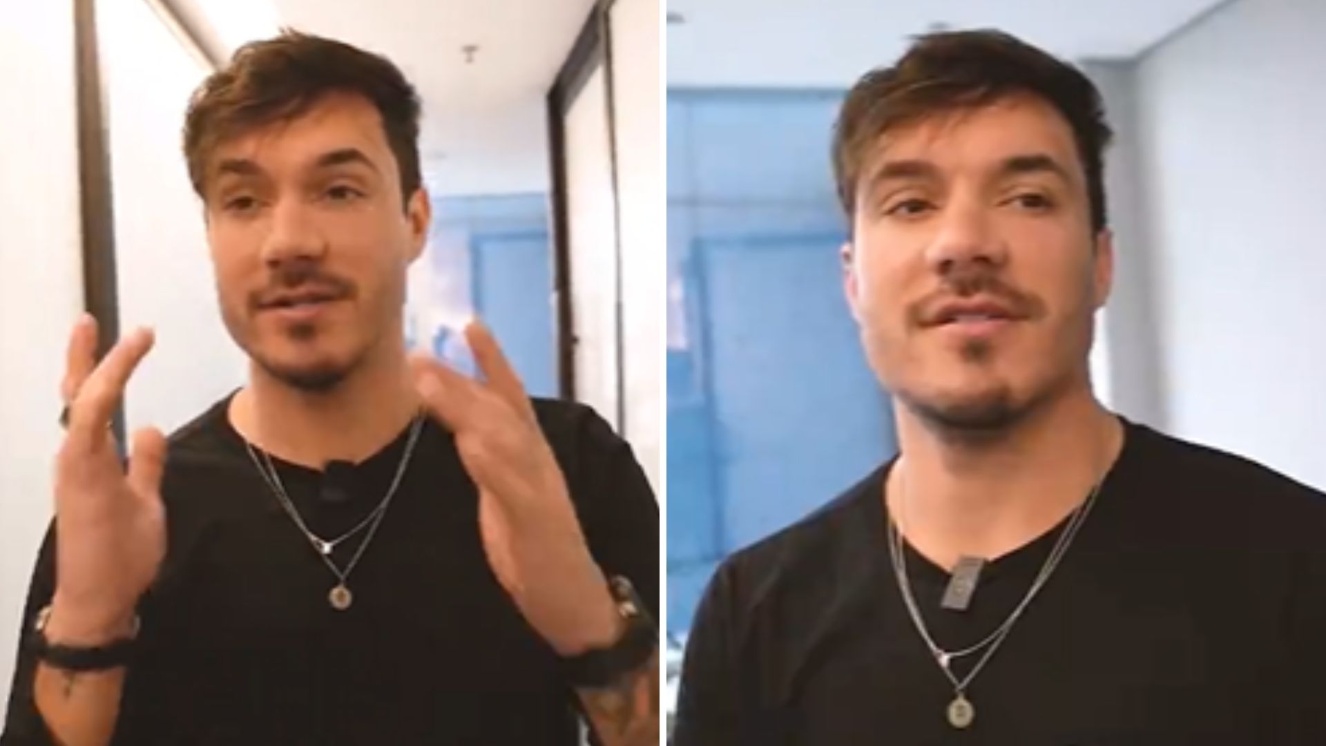 Ex-BBB Eliezer abre o jogo e explica porque fez rinoplastia: “Sendo muito honesto”