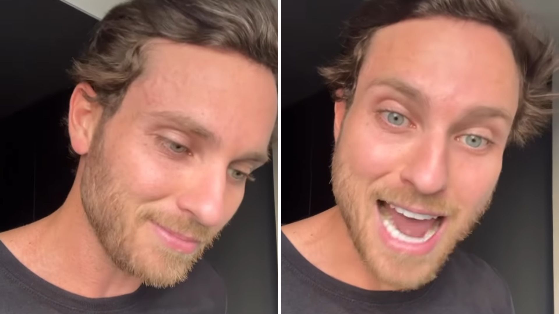 Ex-BBB Lucas Bissoli reage a assalto, luta com bandido e alerta: “Não façam o que fiz”