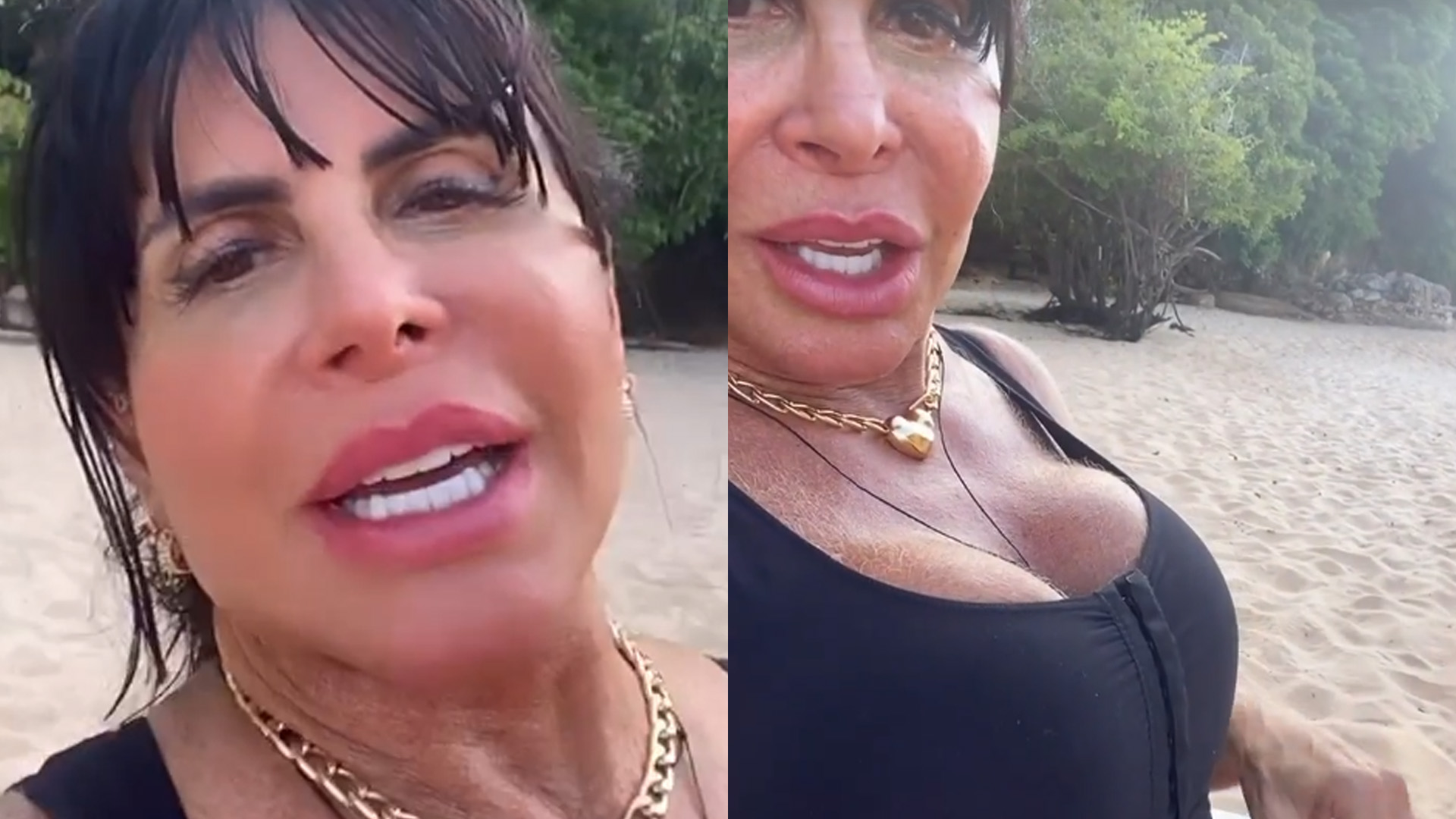 Gretchen mostra resultado de reconstrução do umbigo: “Tá novinho”
