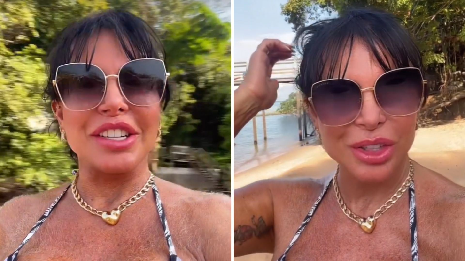 Gretchen entrega mais um procedimento estético após recauchutagem geral: “Gratidão”