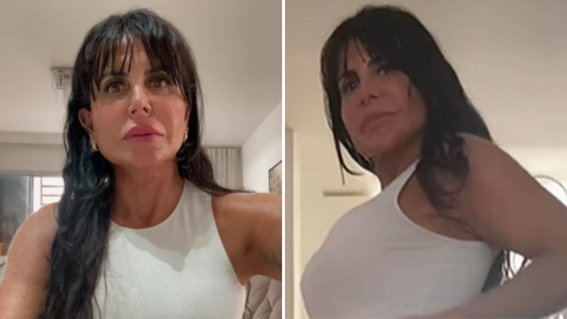 Gretchen rebola e exibe resultado de seu último procedimento estético: “Pediram”