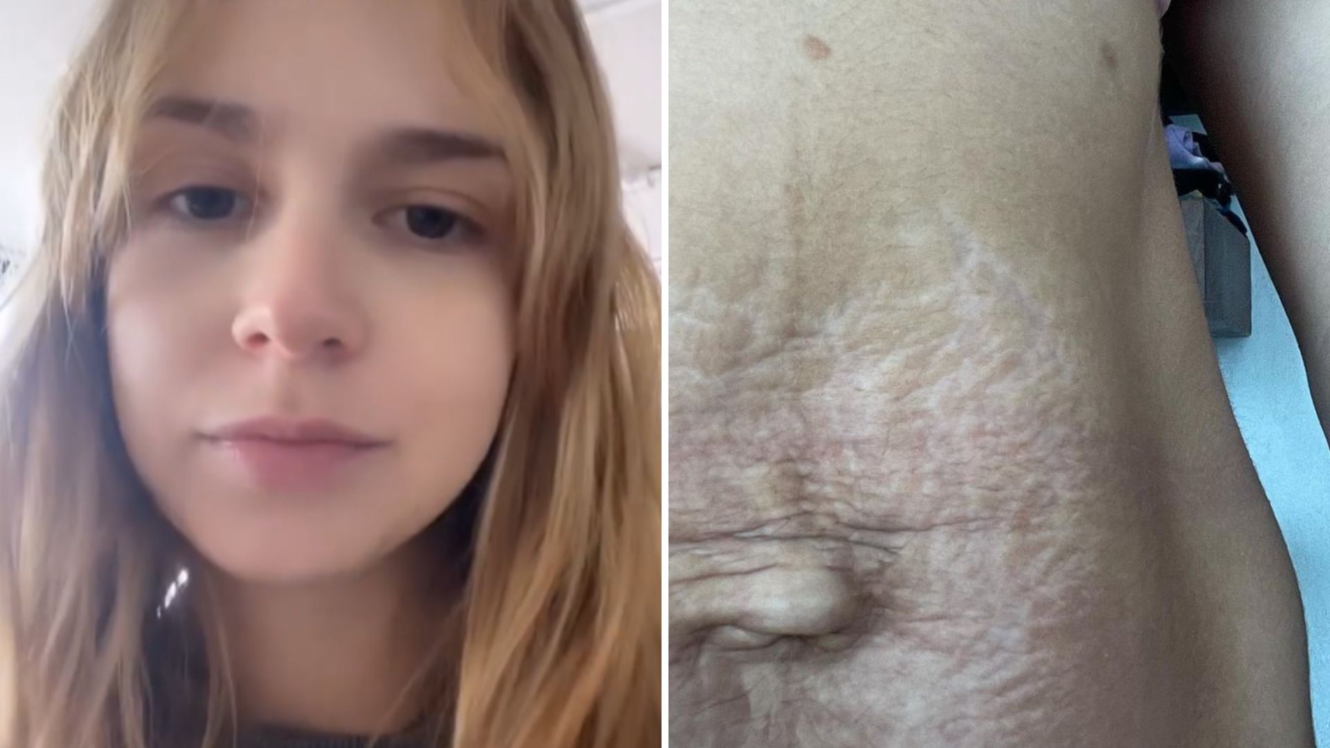 Isa Scherer mostra barriga real um mês após o parto dos gêmeos: “Sem romantização”