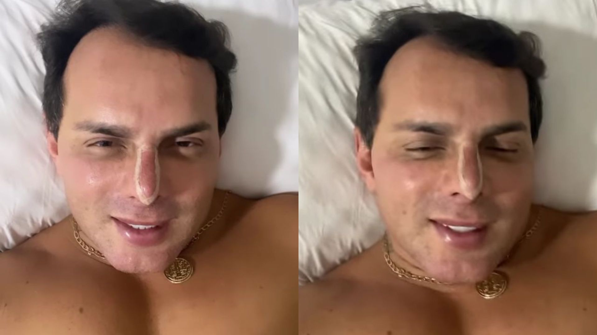 Marido da Gretchen faz novo procedimento estético no rosto e desabafa: “Frustrações”