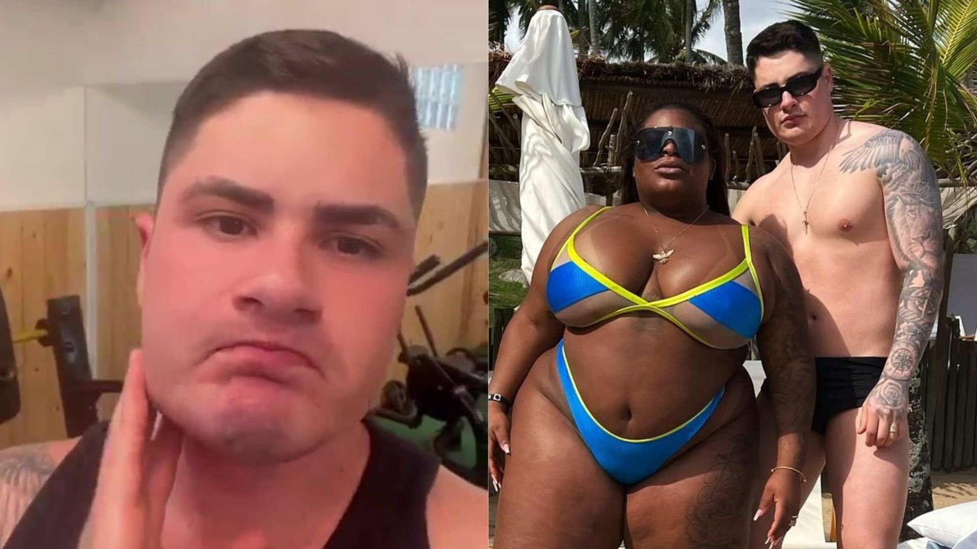 Marido de Jojo Todynho faz procedimento estético no rosto e explica: “Era meio caído”