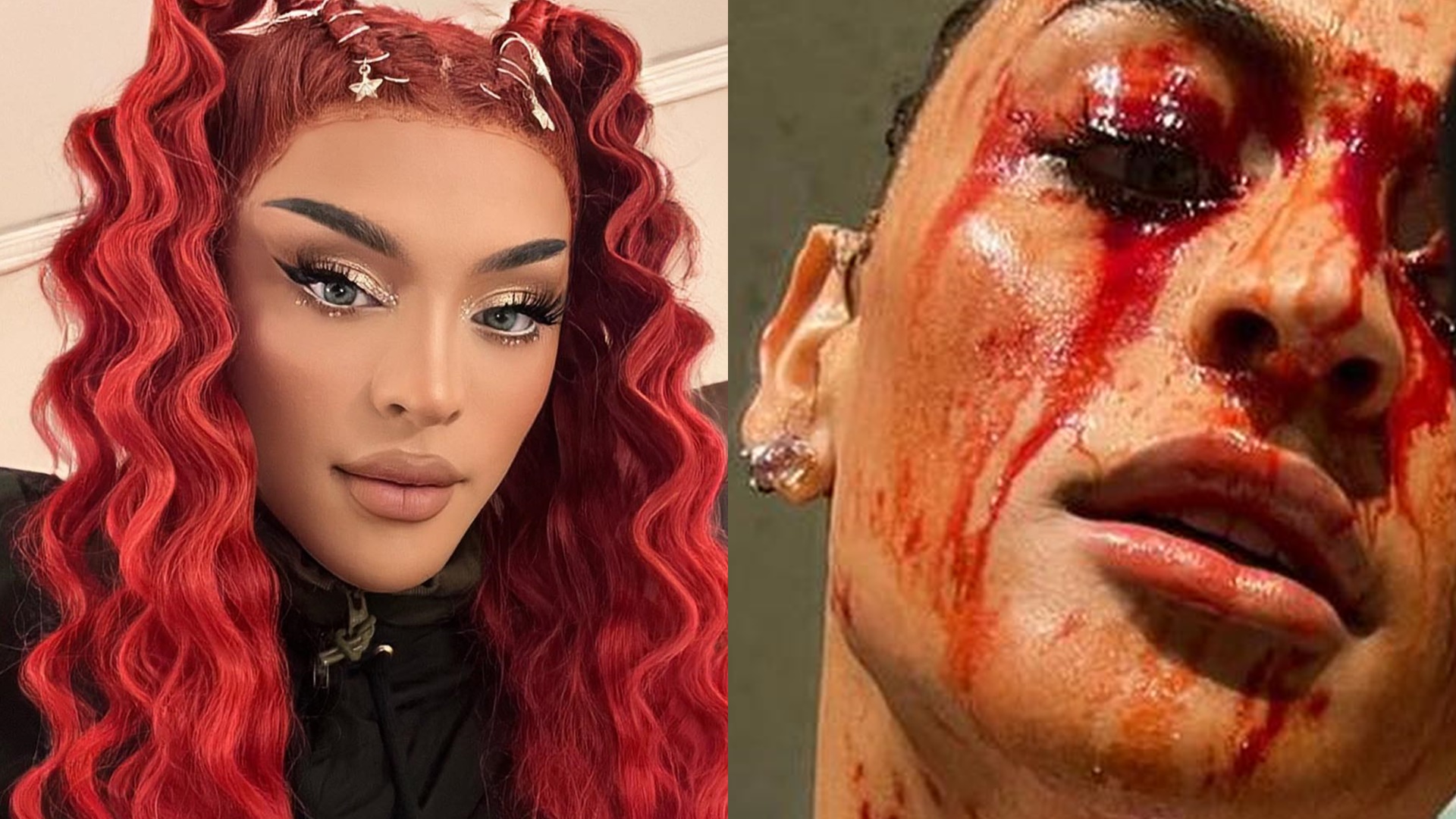 Pabllo Vittar faz mãe entrar em desespero após surgir ensanguentada: “Apanhou de quem?”