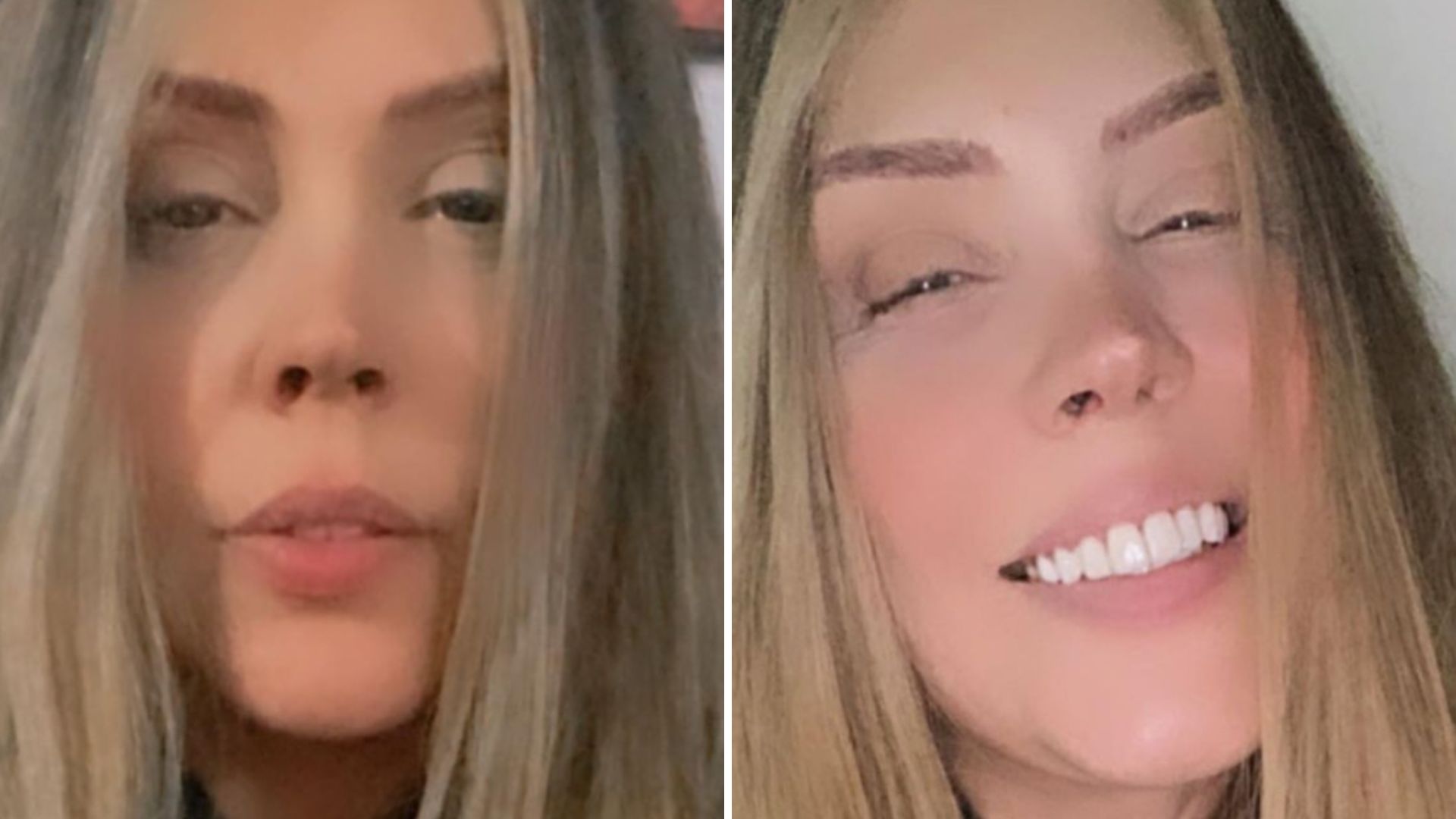 Simony ganha peruca idêntica ao seu cabelo original e se emociona: “Menos sofrimento”