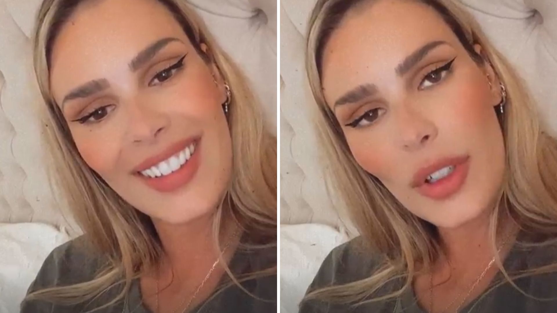 Yasmin Brunet acaba com o mistério e fala sobre suposto procedimento no bumbum: “É gordura”