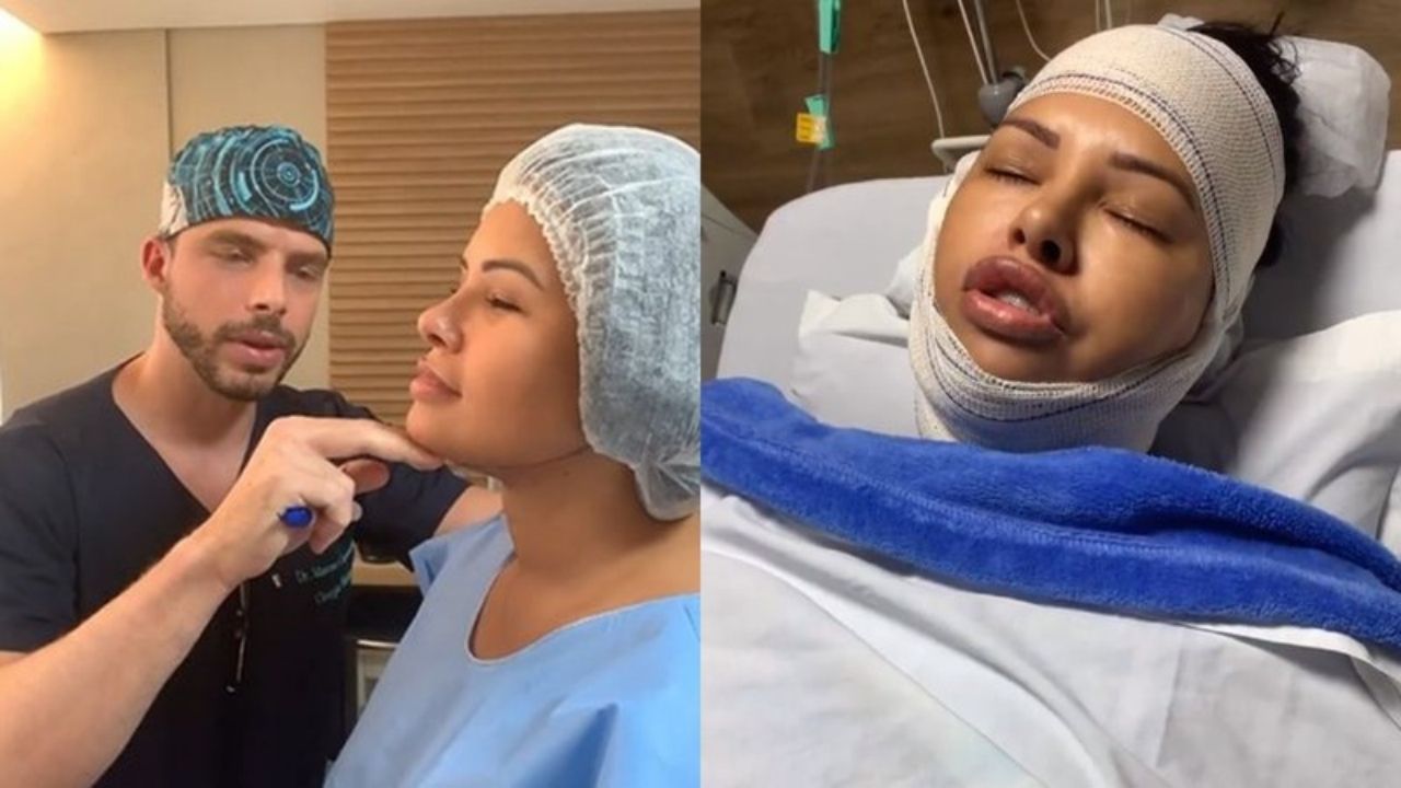 Ex-BBB Ariadna Arantes surge enfaixada após novas plásticas: “Nunca senti tanta dor em uma cirurgia”