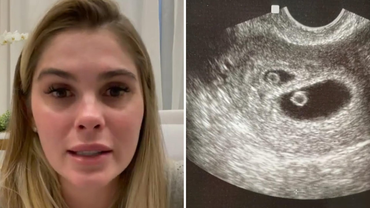 Após anunciar gravidez de gêmeos, Bárbara Evans expõe situação delicada sobre um dos embriões: “Rezem, orem”