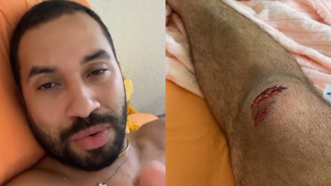 Ex-BBB Gil do Vigor surge ensanguentado após sofrer acidente de bicicleta nos EUA: “Quase desmaiei”