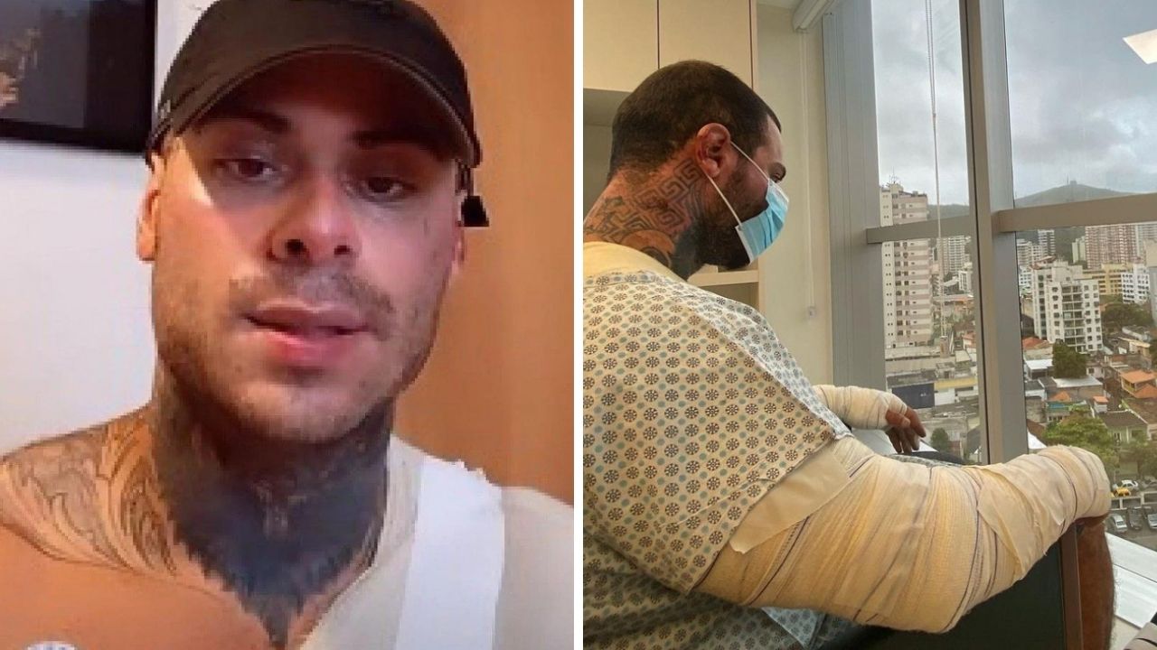 Em desabafo, Leo Stronda revela acidente grave após botijão de gás explodir: “Queimaduras graves”